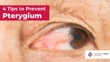Prevent pterygium article header – First Aid Article in Queanbeyan